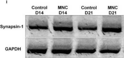 Western Blot: Synapsin I Antibody [NB300-104]